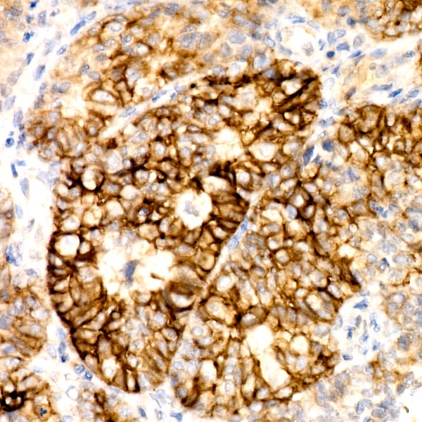CD138/Syndecan-1 Rabbit mAb (Catalog Number: A23248) Abclonal