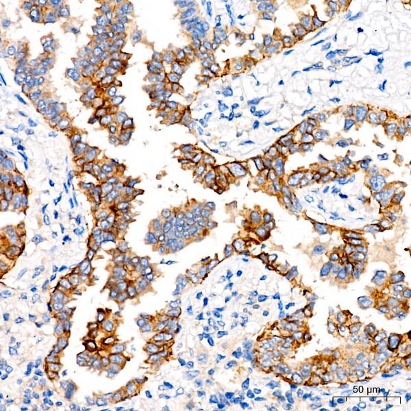 Abclonal CD138/Syndecan-1 Rabbit mAb (Catalog Number: A23248)