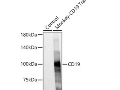 CD19 Rabbit mAb (A23278)