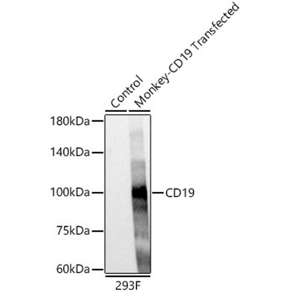 CD19 Rabbit mAb (A23278) CD19 Rabbit mAb (A23278)