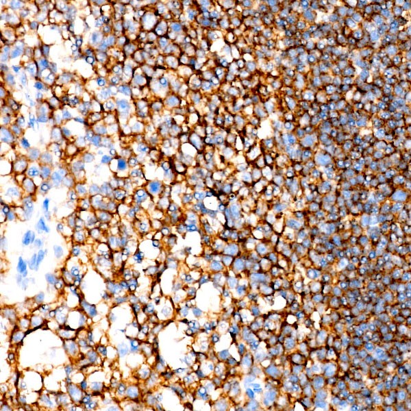 A23278: CD19 Rabbit mAb