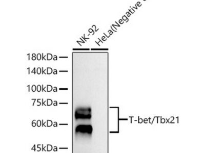 T-bet/Tbx21 Rabbit mAb (A23414)