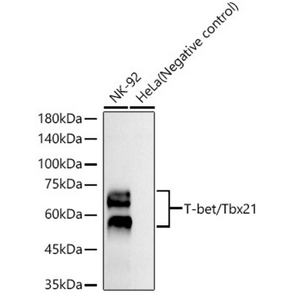 T-bet/Tbx21 Rabbit mAb (A23414) T-bet/Tbx21 Rabbit mAb (A23414)