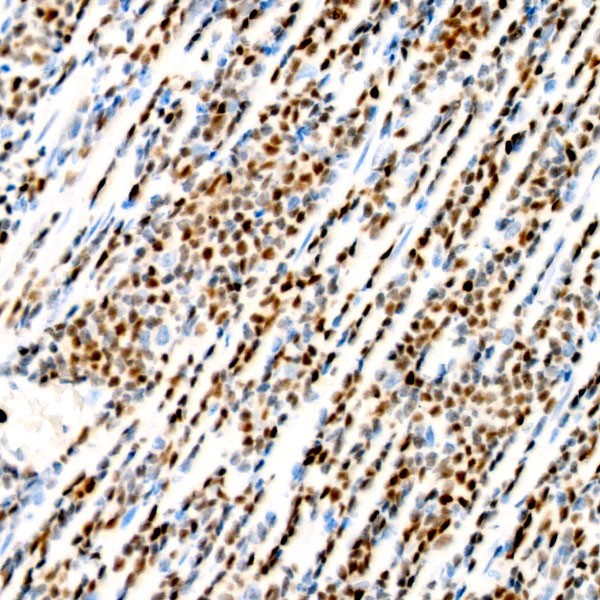 A23414: T-bet/Tbx21 Rabbit mAb