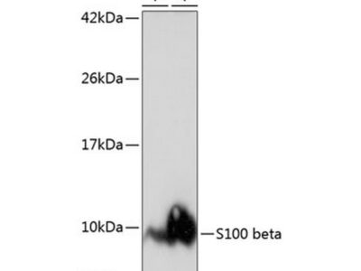 S100B Rabbit mAb (A23493)