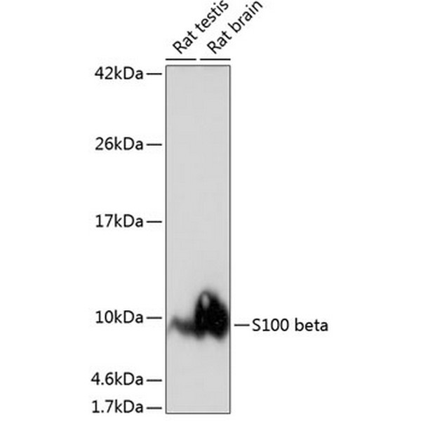 S100B Rabbit mAb (A23493) S100B Rabbit mAb (A23493)