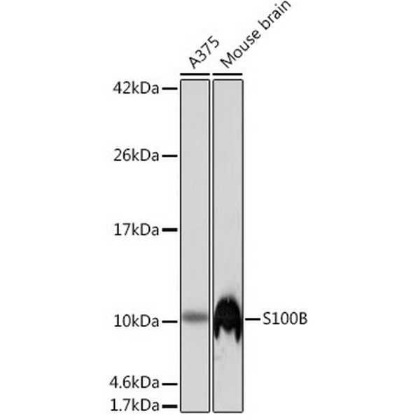 A23493: S100B Rabbit mAb