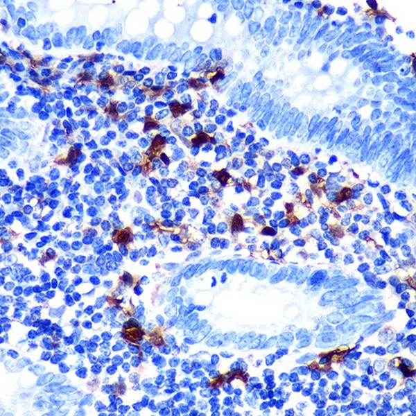 S100B Rabbit mAb (Catalog Number: A23493) Abclonal