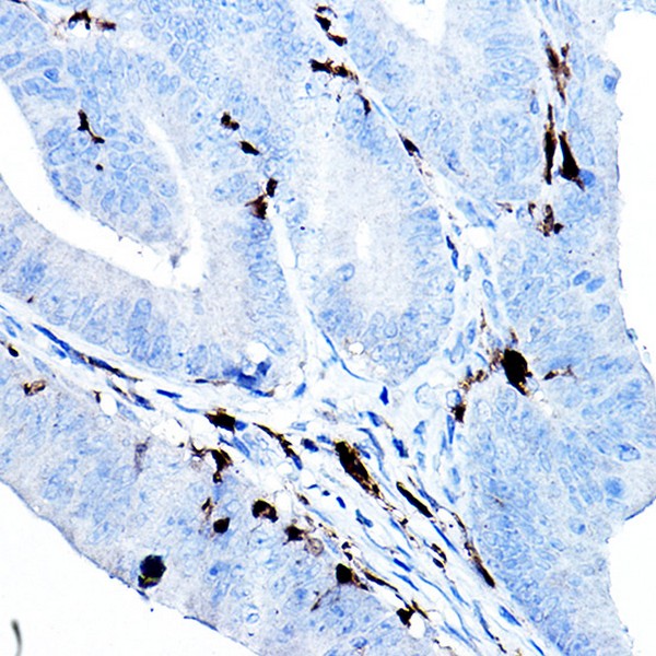 Abclonal S100B Rabbit mAb (Catalog Number: A23493)