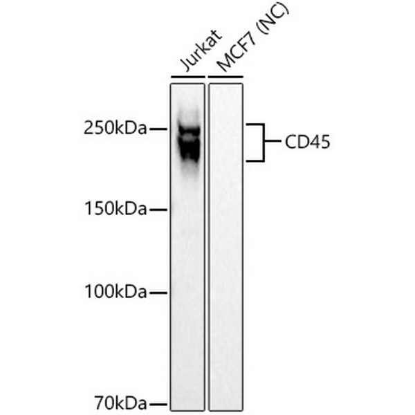 CD45 Rabbit mAb (A23503) CD45 Rabbit mAb (A23503)