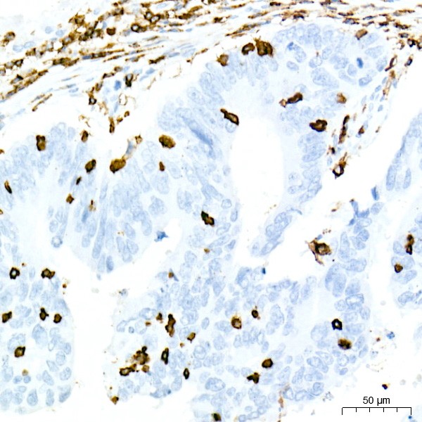 A23503: CD45 Rabbit mAb