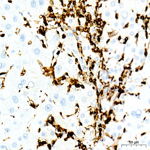 CD45 Rabbit mAb (Catalog Number: A23503) Abclonal