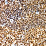 Abclonal CD45 Rabbit mAb (Catalog Number: A23503)
