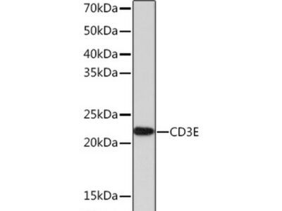 CD3E Rabbit mAb (A23504)