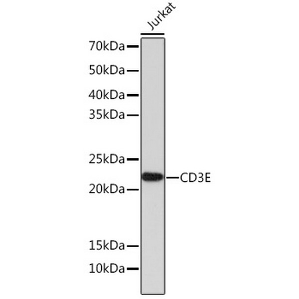 CD3E Rabbit mAb (A23504)