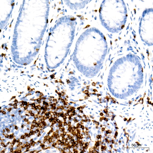 A23504: CD3E Rabbit mAb