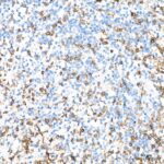 CD3E Rabbit mAb (Catalog Number: A23504) Abclonal