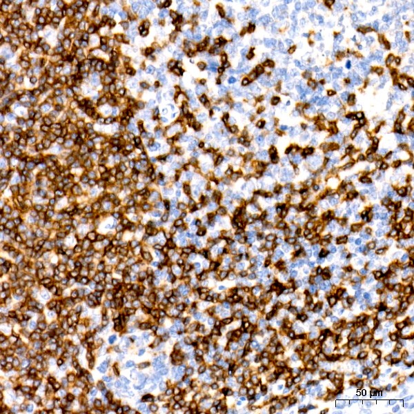 Abclonal CD3E Rabbit mAb (Catalog Number: A23504)