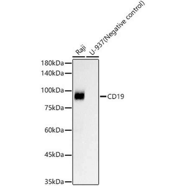 CD19 Rabbit mAb (A23507) CD19 Rabbit mAb (A23507)