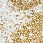 CD19 Rabbit mAb (Catalog Number: A23507) Abclonal