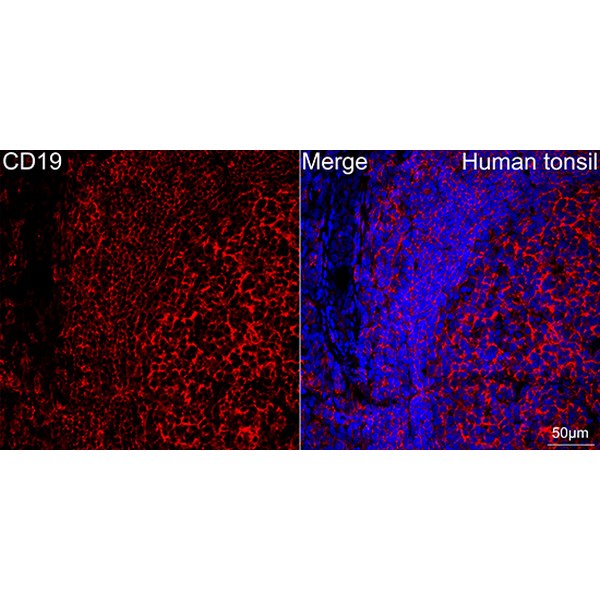 Abclonal CD19 Rabbit mAb (Catalog Number: A23507)