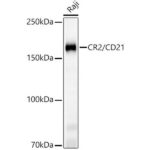 CR2/CD21 Rabbit mAb (A23512)