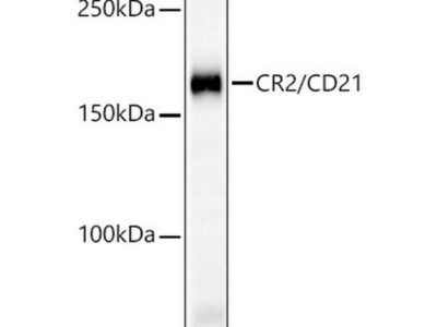 CR2/CD21 Rabbit mAb (A23512)