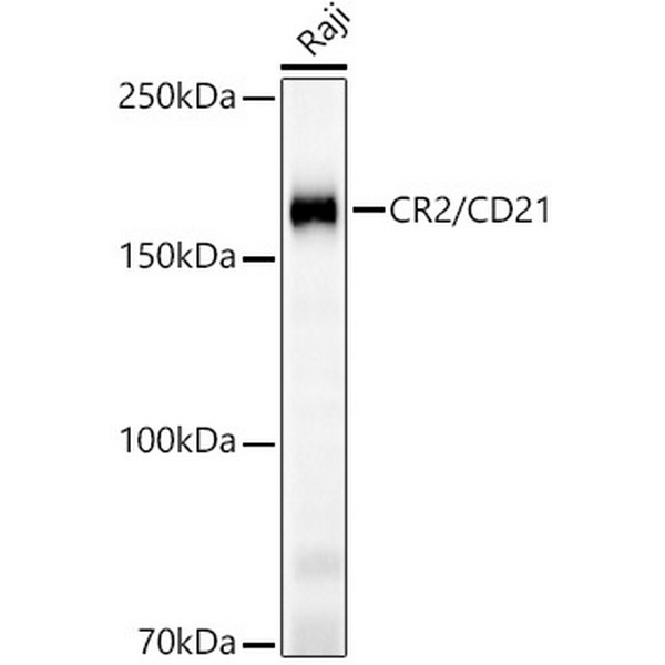 CR2/CD21 Rabbit mAb (A23512) CR2/CD21 Rabbit mAb (A23512)