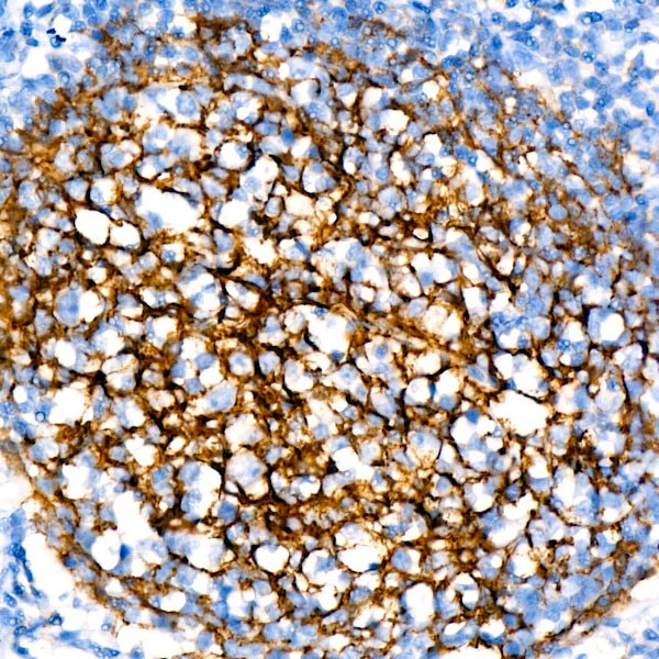 A23512: CR2/CD21 Rabbit mAb