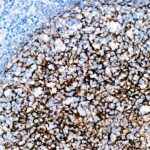 CR2/CD21 Rabbit mAb (Catalog Number: A23512) Abclonal