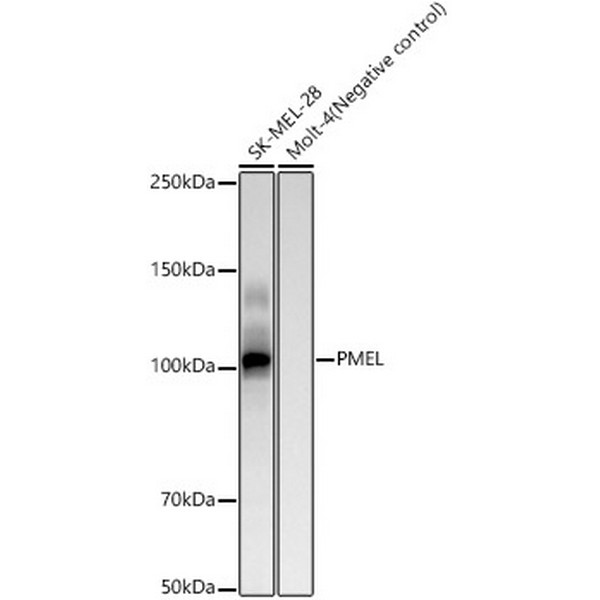 PMEL Rabbit mAb (A23684) PMEL Rabbit mAb (A23684)