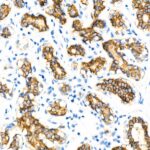 E-Cadherin mouse mAb (A3149)