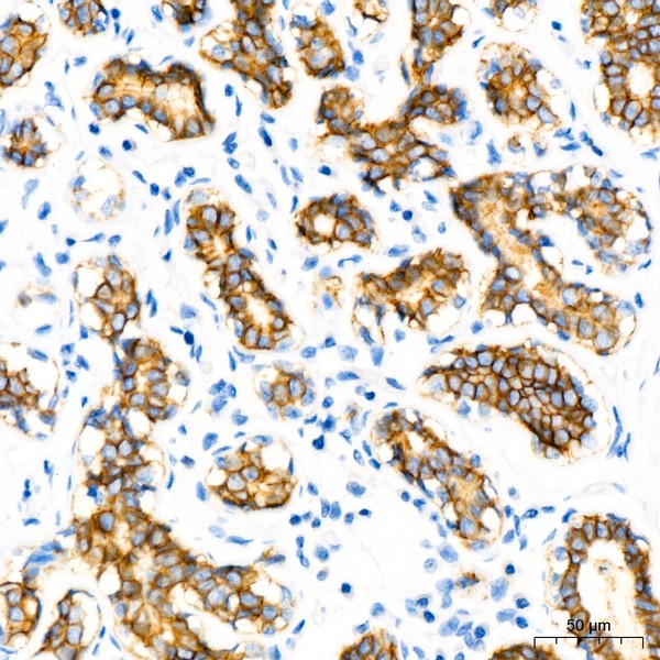 E-Cadherin mouse mAb (A3149)