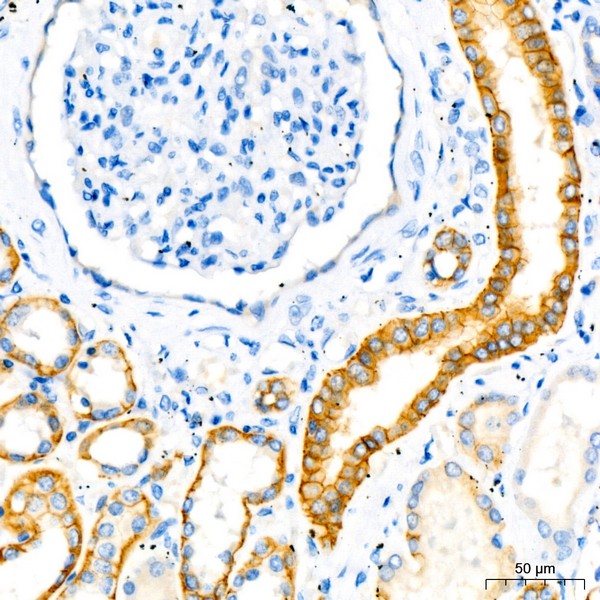 A3149: E-Cadherin mouse mAb