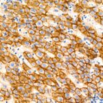 E-Cadherin mouse mAb (Catalog Number: A3149) Abclonal