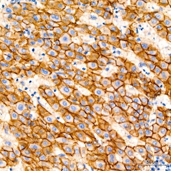 E-Cadherin mouse mAb (Catalog Number: A3149) Abclonal