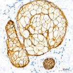 Abclonal E-Cadherin mouse mAb (Catalog Number: A3149)