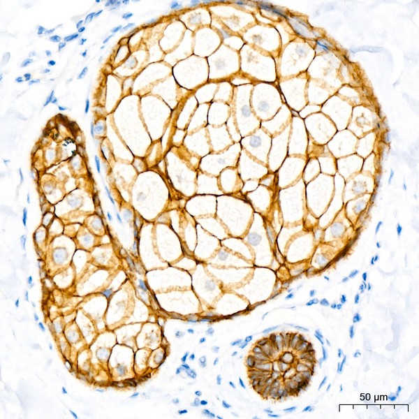 Abclonal E-Cadherin mouse mAb (Catalog Number: A3149)
