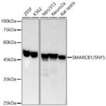 [KO Validated] SMARCB1/SNF5 Rabbit mAb (A3247)