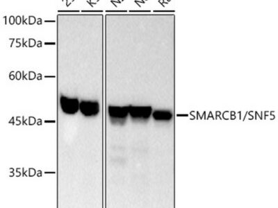 [KO Validated] SMARCB1/SNF5 Rabbit mAb (A3247)