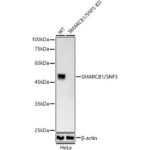 A3247: [KO Validated] SMARCB1/SNF5 Rabbit mAb