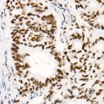 Abclonal [KO Validated] SMARCB1/SNF5 Rabbit mAb (Catalog Number: A3247)