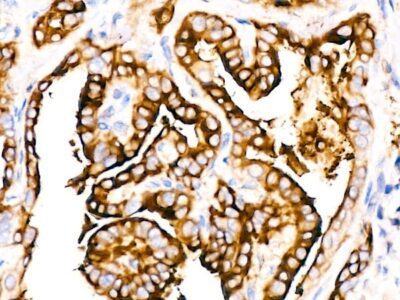 Thyroglobulin Rabbit mAb (A3407)
