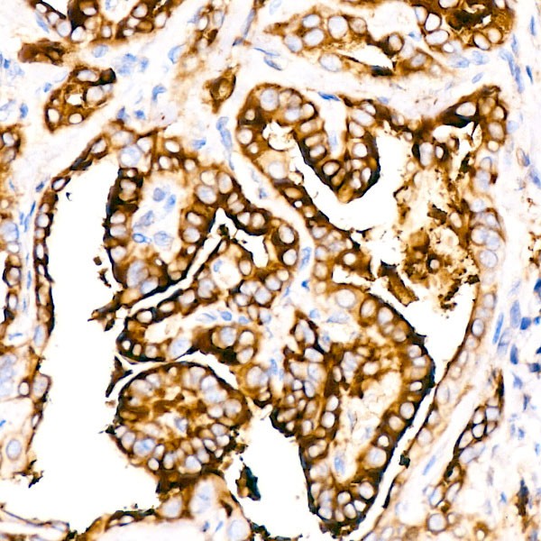 Thyroglobulin Rabbit mAb (A3407) Thyroglobulin Rabbit mAb (A3407)