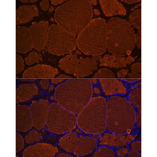 A3407: Thyroglobulin Rabbit mAb