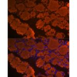 Abclonal Thyroglobulin Rabbit mAb (Catalog Number: A3407)