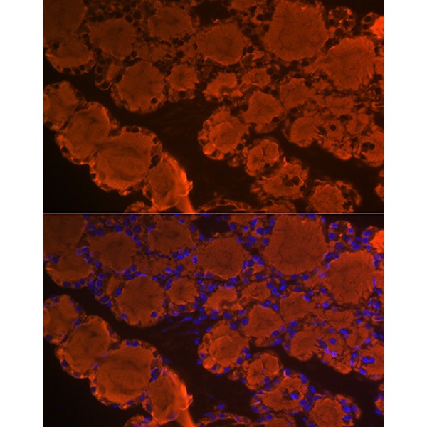 Abclonal Thyroglobulin Rabbit mAb (Catalog Number: A3407)