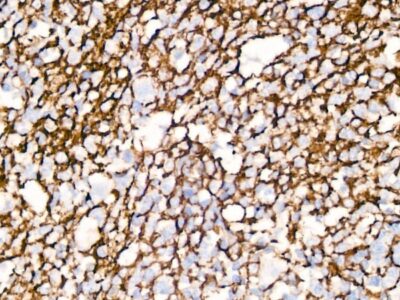 CD35/CR1 Rabbit mAb (A3661)