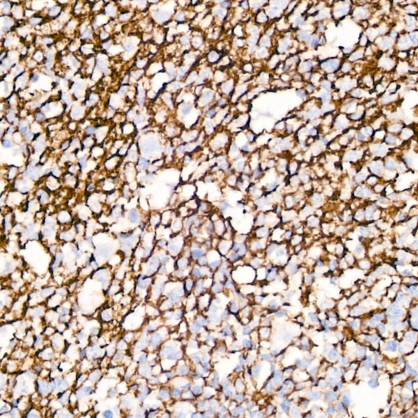 CD35/CR1 Rabbit mAb (A3661) CD35/CR1 Rabbit mAb (A3661)