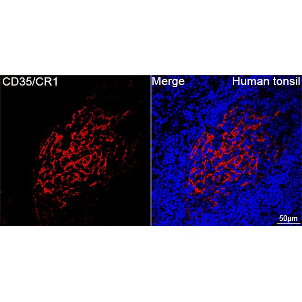 A3661: CD35/CR1 Rabbit mAb